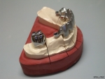 Armature fraisée